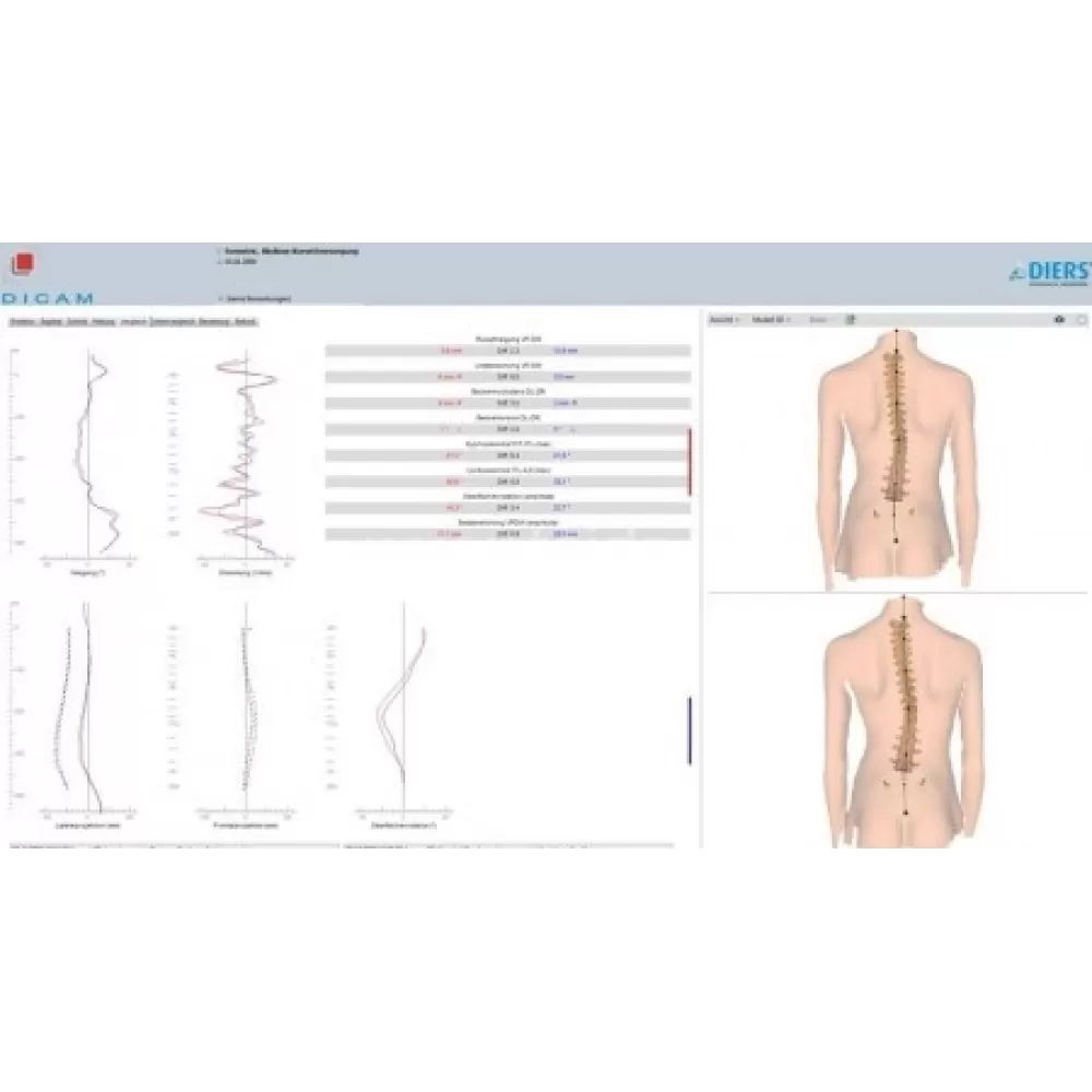 DIERS Statico 3D stuburo ir laikysenos diagnostinė sistema