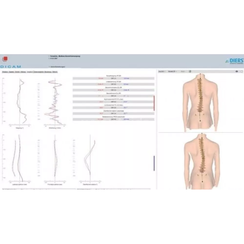 DIERS Statico 3D stuburo ir laikysenos diagnostinė sistema